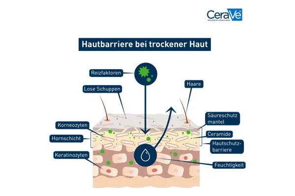 Aufbau der Hautbarriere bei trockener und empfindlicher Haut im Querschnitt dargestellt